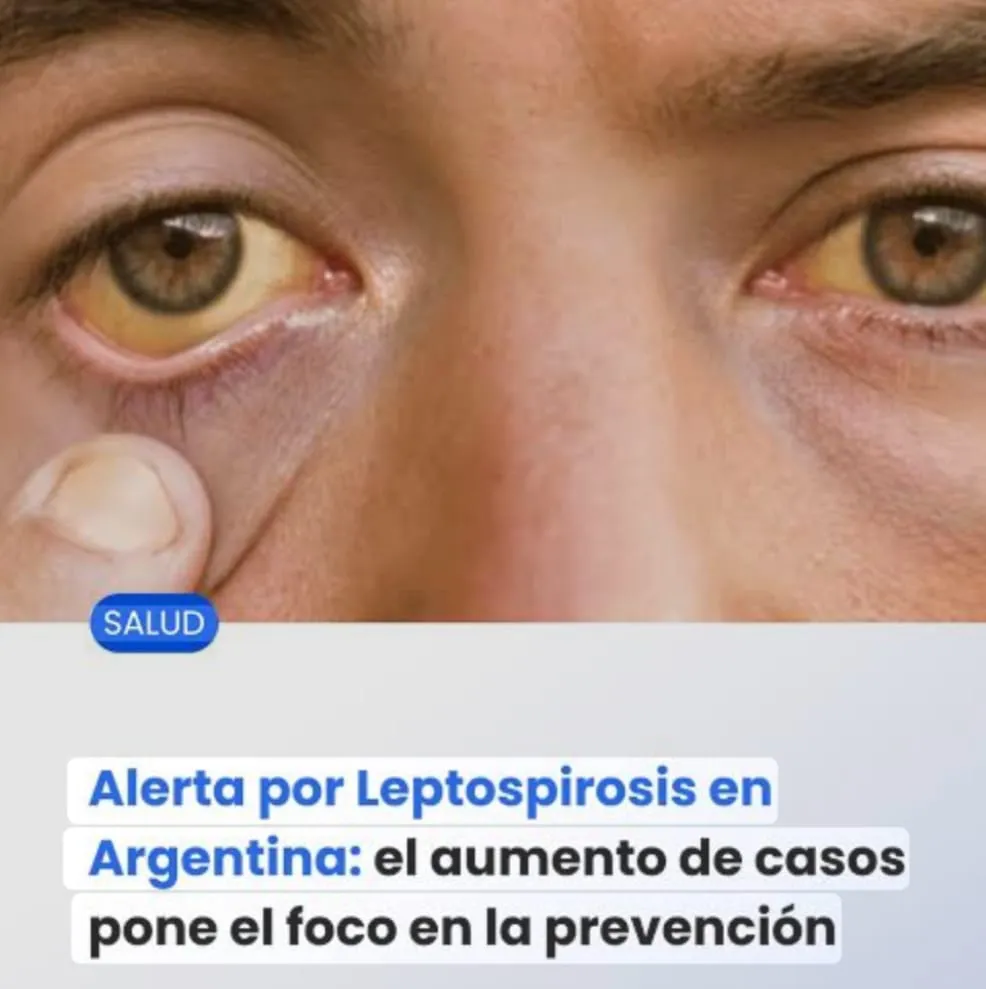 WhatsApp Image 2026-01-05 at 22.07.56lectopirosis