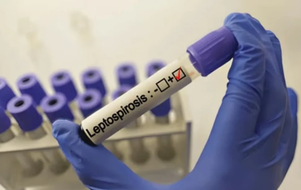 WhatsApp Image 2026-04-09 at 21.33.59lactospirosis